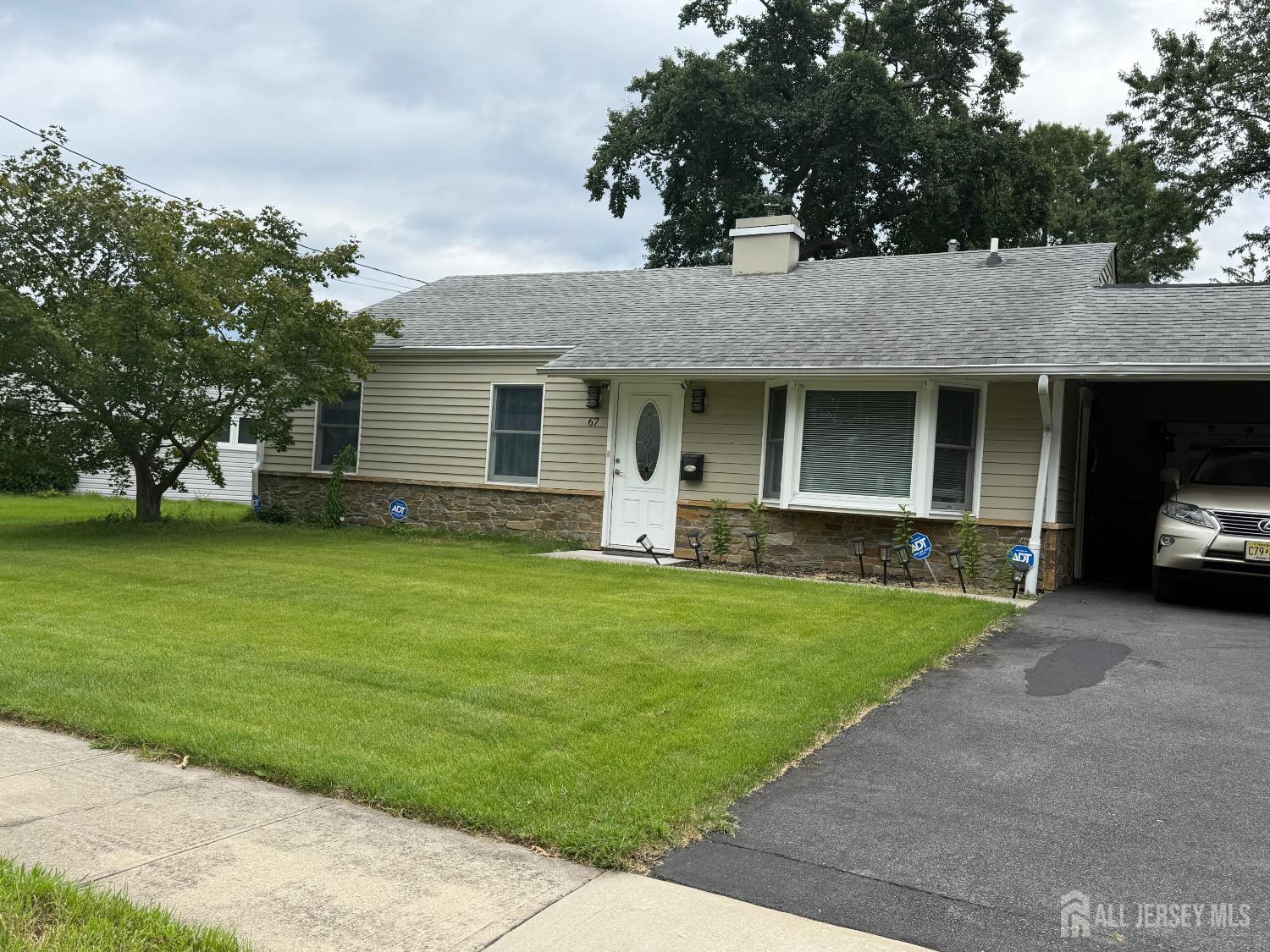 67 Winthrop Road — photo