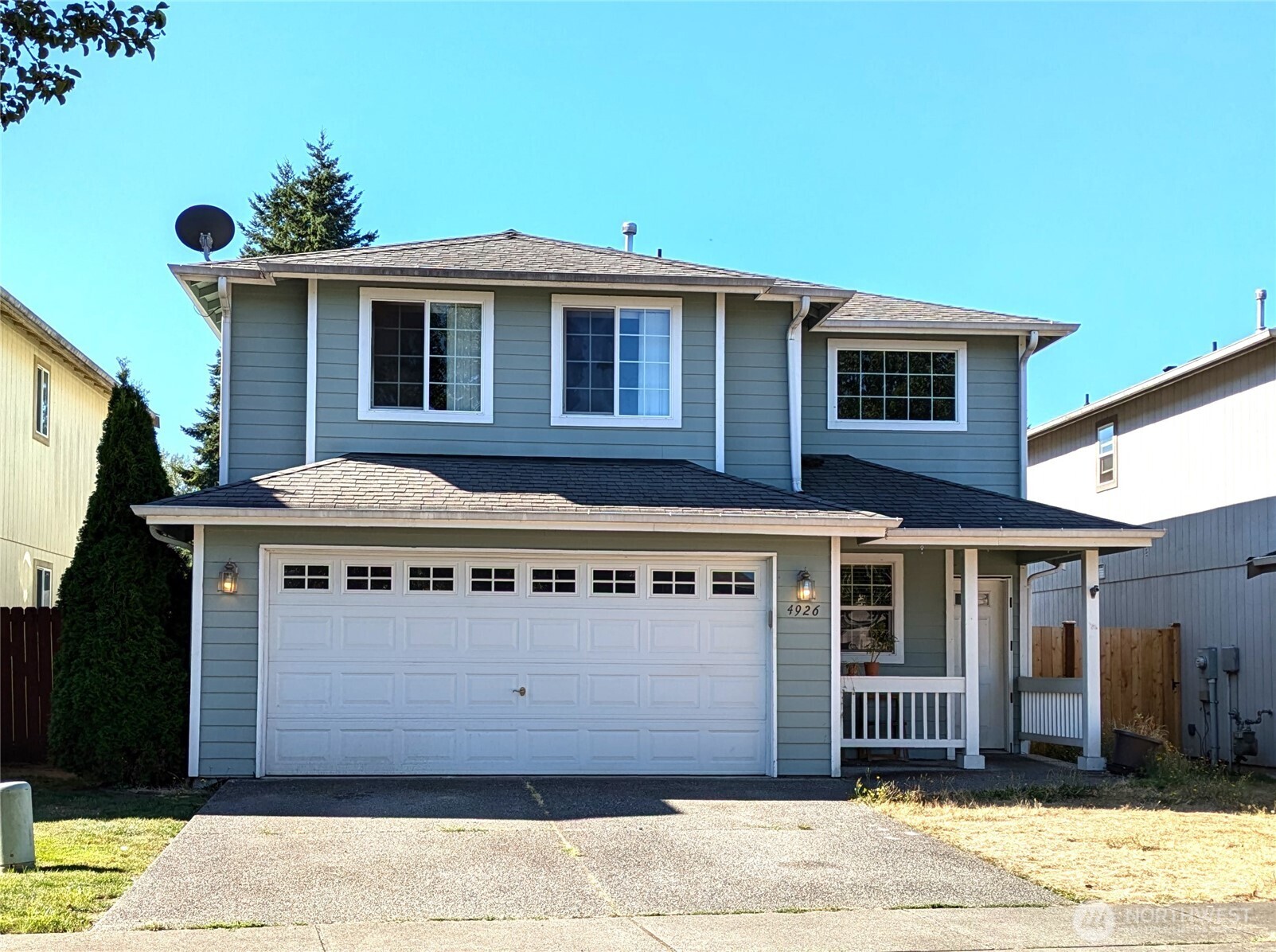 4926 104th Place NE — photo