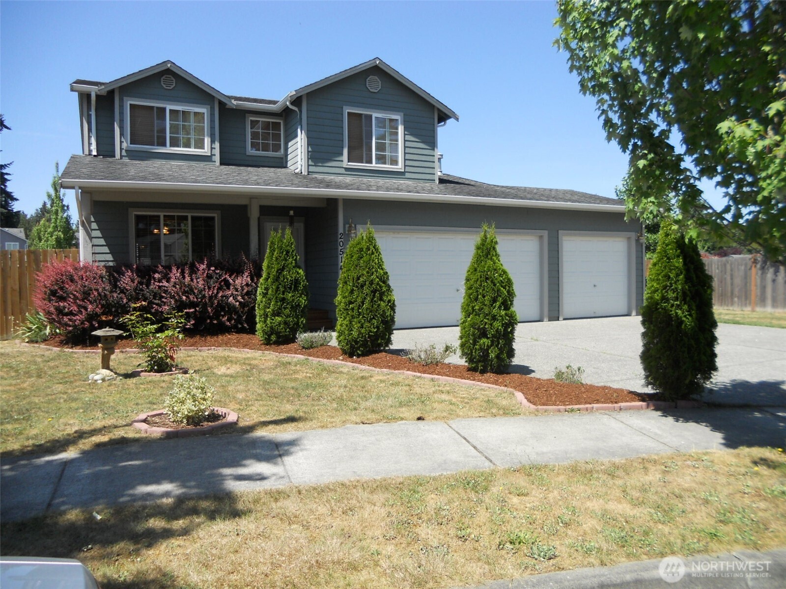 20514 66th Drive NE — photo