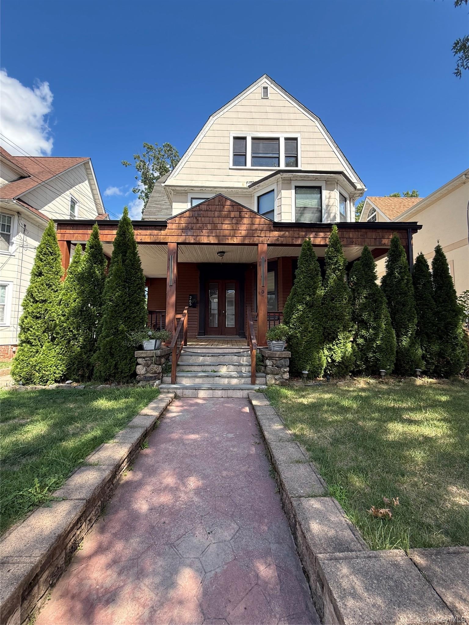 265 Summit Avenue 3 — photo